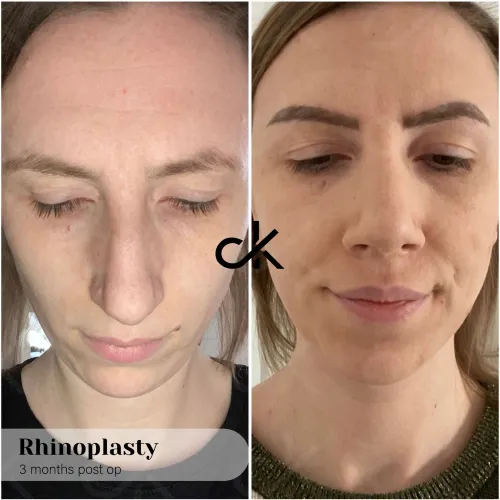 WhatsApp Image 2023-04-17 at 10.19.48 (1)