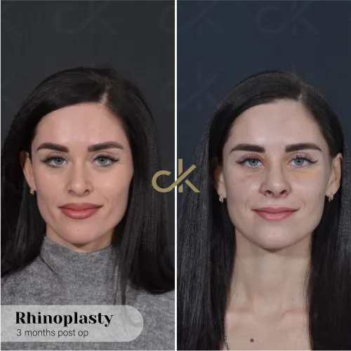 WhatsApp Image 2023-04-17 at 10.19.54 (2)