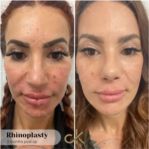 WhatsApp Image 2023-04-17 at 10.20.03